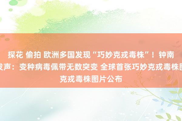 探花 偷拍 欧洲多国发现“巧妙克戎毒株”！钟南山最新发声：变种病毒佩带无数突变 全球首张巧妙克戎毒株图片公布